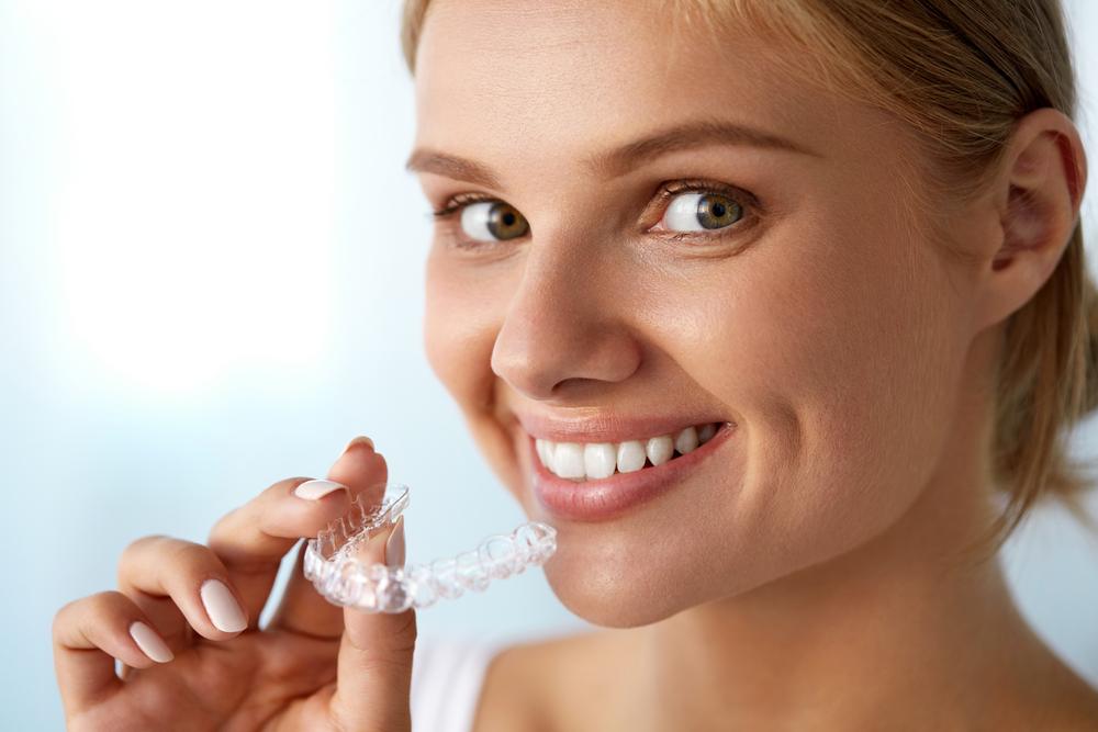 Clear Aligners at Griffin Dental