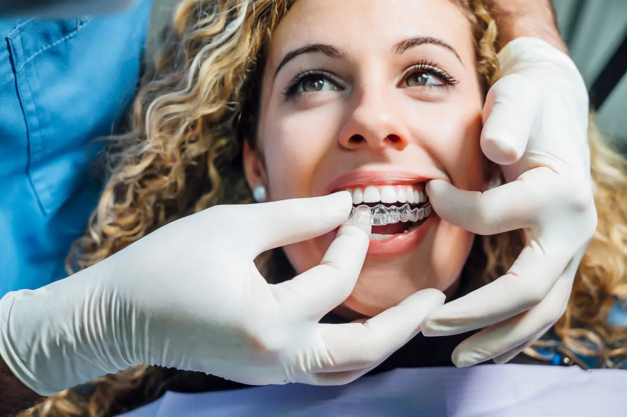 Clear Aligners In Marshall, TX: A Discreet Way To Straighten Your Smile