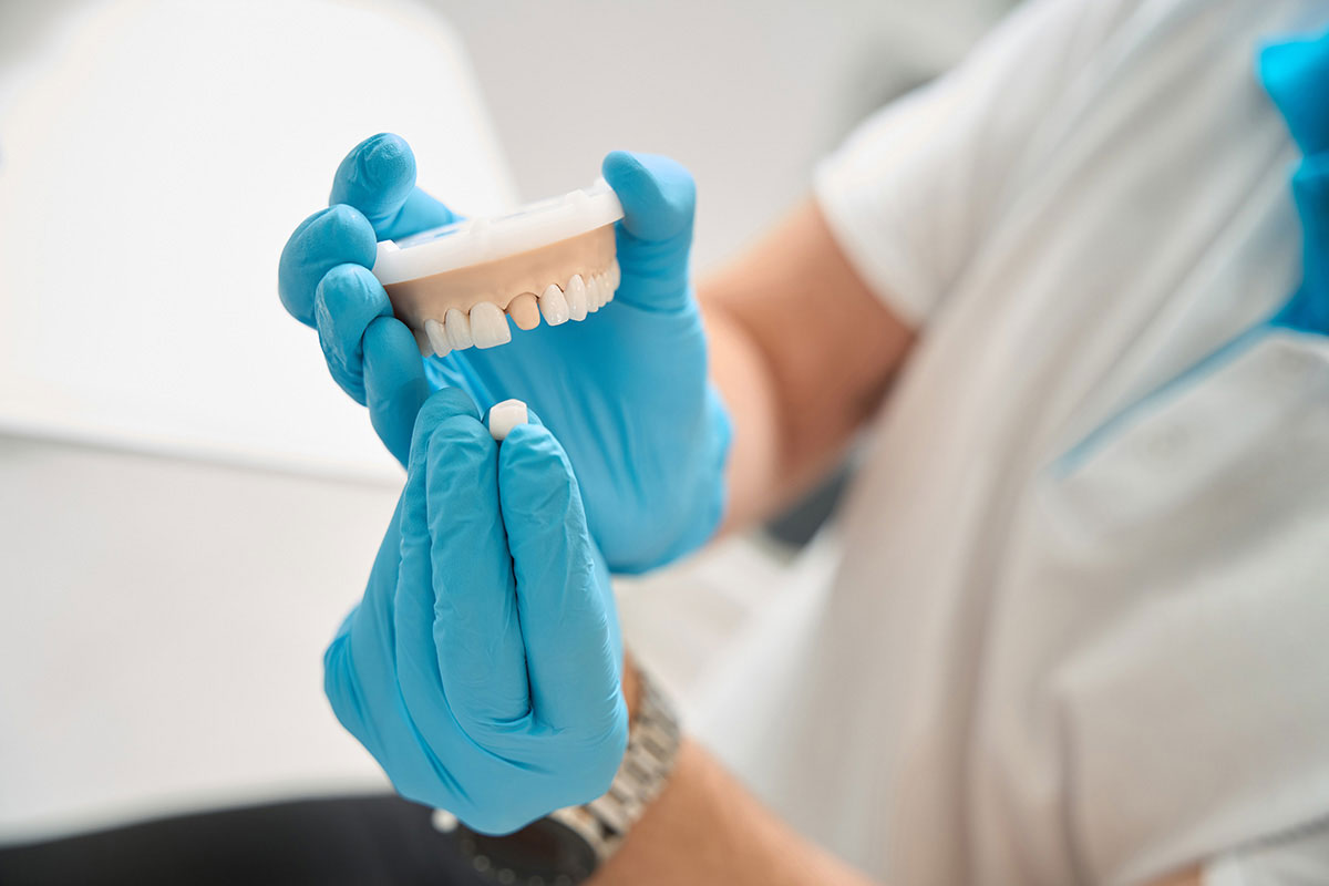 Lost Dental Crown Or Filling In Marshall, TX: What To Do And When To Call