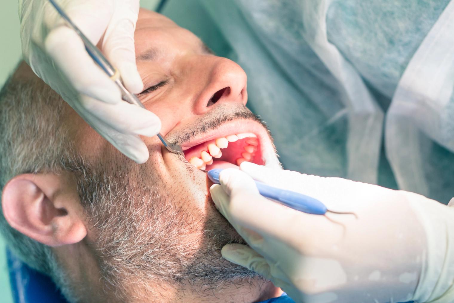 A man with a beard receives dental treatment, with gloved hands holding tools in his open mouth.
